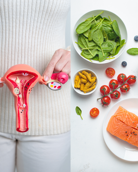 Endométriose et alimentation anti-inflammatoire : les meilleurs aliments pour soutenir le corps au quotidien
