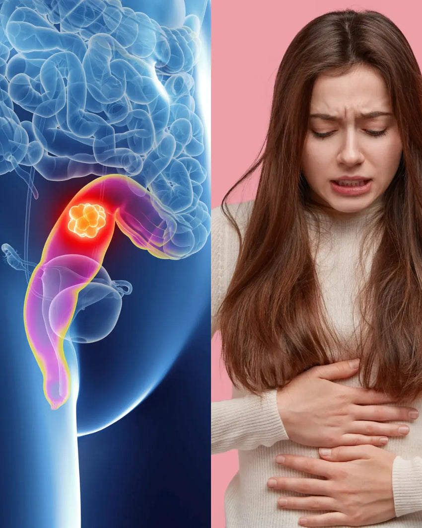 Illustration d’une douleur au rectum pendant les règles pouvant être associée à l’endométriose