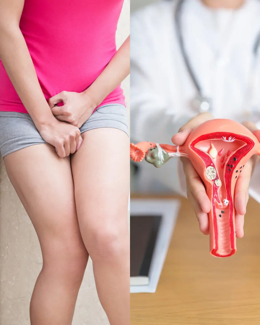 Endométriose et envie fréquente d’uriner : pourquoi ?