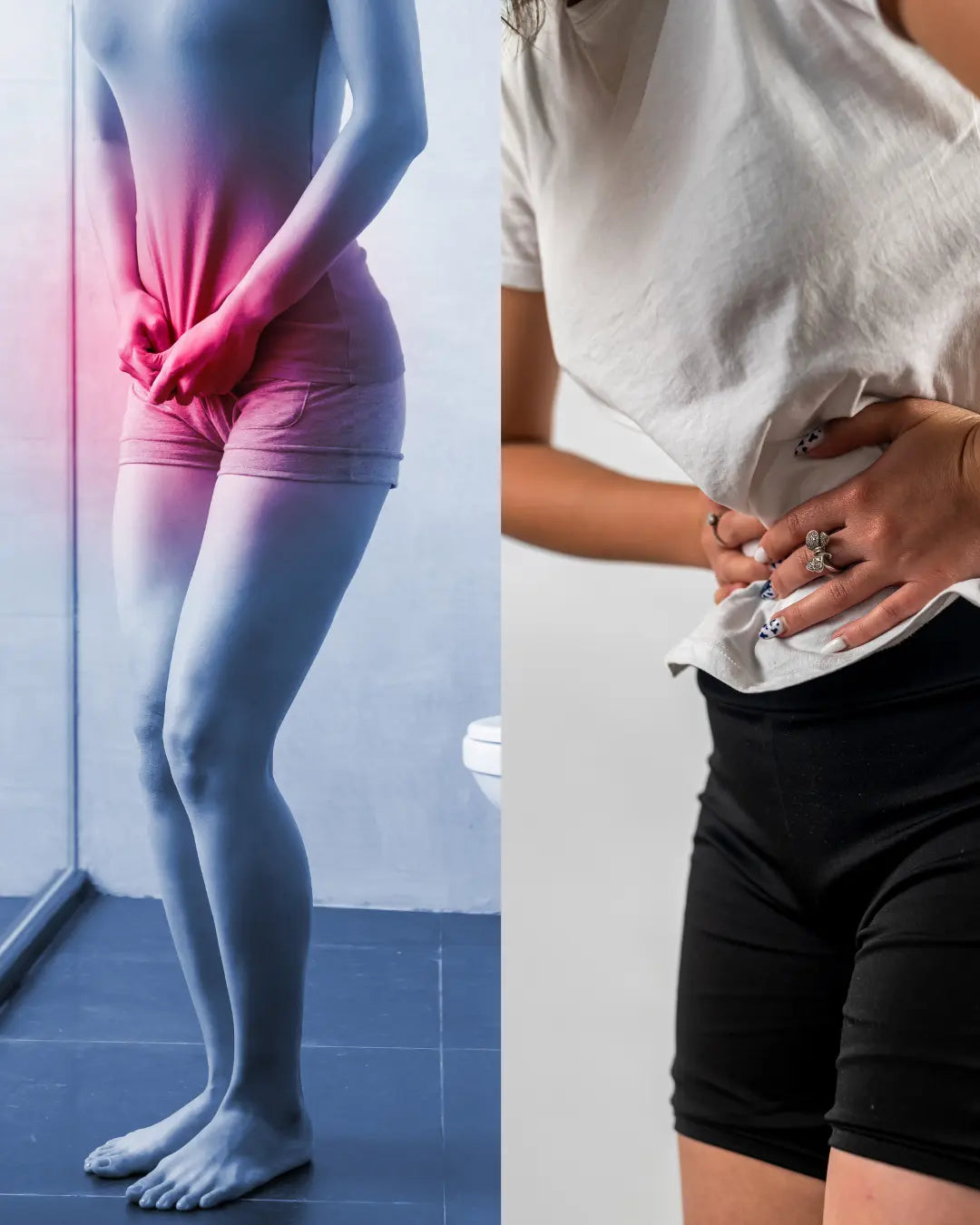 Femme souffrant de troubles urinaires liés à l'endométriose